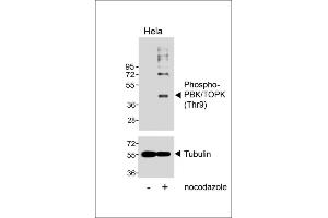 Western blot analysis of lysates from Hela cell line, untreated or treated with Nocodazole, 100 ng/mL, using Phospho-PBK/TOPK (Thr9) Antibody (upper) or Tubulin (lower). (PBK Antikörper  (pThr9))