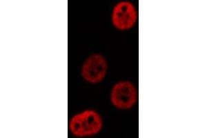 Immunofluorescence (fixed cells) (IF/ICC) image for anti-Proteasome Subunit Alpha Type 3 (PSMA3) (Internal Region) antibody (ABIN6266152)