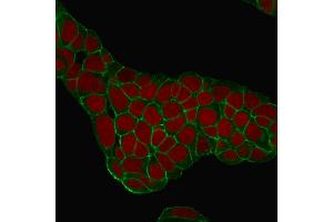 Confocal Immunofluorescence of MCF-7 cells EpCAM Mouse Monoclonal Antibody (EGP40/1384). (EpCAM Antikörper  (Extracellular Domain))