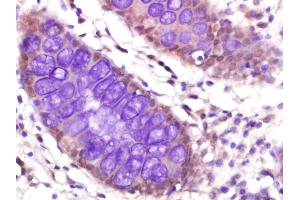 Immunohistochemistry (Paraffin-embedded Sections) (IHC (p)) image for anti-Protein Phosphatase 2, Catalytic Subunit, beta Isozyme (PPP2CB) (AA 21-120) antibody (ABIN720236)