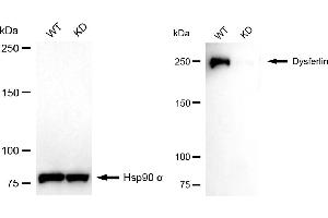 Western blotting analysis using dysferlin antibody (ABIN7798406). (Rekombinanter Dysferlin Antikörper)