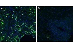 Expression of Calcitonin Receptor-Like Receptor in mouse brain stemImmunohistochemical staining of perfusion-fixed frozen mouse brain sections with Anti-CRLR/CALCRL (extracellular) (extracellular) Antibody (ABIN7042979, ABIN7044198 and ABIN7044199), (1:200), followed by goat anti-rabbit-AlexaFluor-488. (Calcitonin Receptor-Like (CALCRL) Peptid)