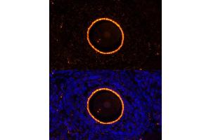 Immunofluorescence analysis of rat oophoroma cells using ZP2 antibody (ABIN6128965, ABIN6150534, ABIN6150535 and ABIN6214263) at dilution of 1:100. (ZP2 Antikörper  (AA 651-745))