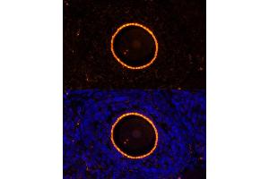 Immunofluorescence analysis of rat oophoroma cells using ZP2 antibody (ABIN6128965, ABIN6150534, ABIN6150535 and ABIN6214263) at dilution of 1:100. (ZP2 Antikörper  (AA 651-745))