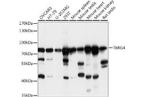 Western blot analysis of extracts of various cell lines, using TBRG4 antibody  at 1:1000 dilution. (TBRG4 Antikörper  (AA 382-631))