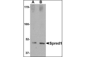 Western blot analysis of Spred1 in human brain tissue lysate with this product at (A) 1 and (B) 2 μg/ml. (SPRED1 Antikörper  (Center))