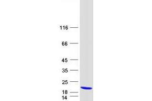 Validation with Western Blot