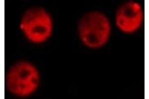 ABIN6277892 staining Hela cells by IF/ICC. (ERG Antikörper  (C-Term))