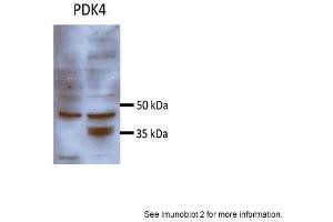 Sample Type: Huh7 HepG2 (50ug)Primary Antibody Dilution: 1:500 Image Submitted By: Partha KasturiUniversity of Kansas Medical Center (PDK4 Antikörper  (N-Term))
