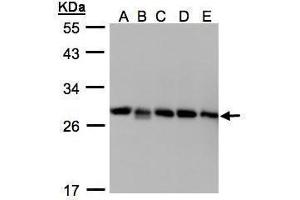 WB Image Sample(30μg whole cell lysate) A: 293T B: A431 , C: H1299 D: HeLa S3 , E: Hep G2 , 12% SDS PAGE antibody diluted at 1:1000 (ARHGDIB Antikörper)