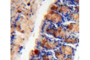 Used in DAB staining on fromalin fixed paraffin-embedded Intestine tissue (Mucosae Associated Epithelia Chemokine (AA 20-115) Antikörper)