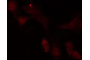 ABIN6272426 staining Hela by IF/ICC. (SCAND1 Antikörper  (N-Term))