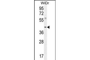 DUS4L Antibody (Center) (ABIN654982 and ABIN2844622) western blot analysis in WiDr cell line lysates (35 μg/lane). (DUS4L Antikörper  (AA 141-170))