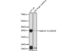 Western blot analysis of extracts of various cell lines, using Galectin 4/LG Rabbit mAb (ABIN1679347, ABIN3017979, ABIN3017980 and ABIN7101554) at 1:1000 dilution. (GAL4 Antikörper)