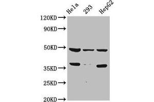 Western Blot Positive WB detected in: Hela whole cell lysate, 293 whole cell lysate, HepG2 whole cell lysate All lanes: SOX4 antibody at 1:2000 Secondary Goat polyclonal to rabbit IgG at 1/50000 dilution Predicted band size: 48 kDa Observed band size: 48 kDa (SOX4 Antikörper  (AA 1-60))
