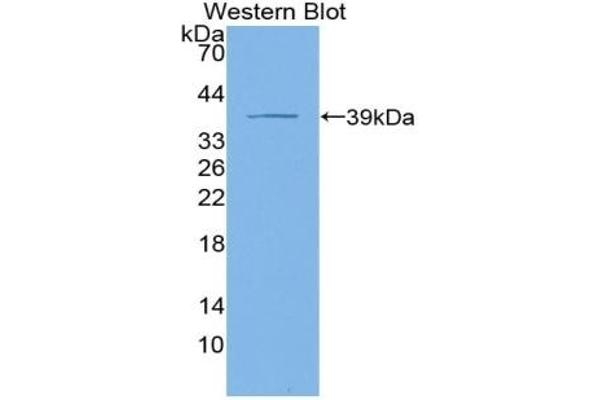 KRT4 Antikörper  (AA 152-457)