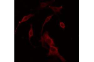ABIN6266814 staining COLO205 cells by IF/ICC.