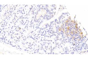 Immunohistochemistry (IHC) image for anti-Interleukin 1 Receptor Antagonist (IL1RN) (AA 26-177) antibody (APC) (ABIN7431377)