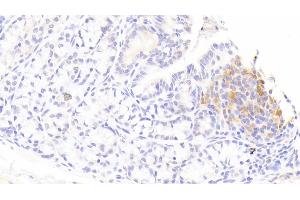 Detection of IL1RA in Rabbit Colon Tissue using Polyclonal Antibody to Interleukin 1 Receptor Antagonist (IL1RA)