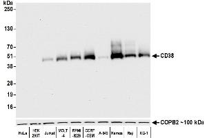 Western Blotting (WB) image for anti-CD38 (AA 43-300) antibody (ABIN7453961) (Rekombinanter CD38 Antikörper  (AA 43-300))