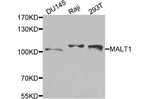 Western blot analysis of extracts of various cells, using MALT1 antibody. (MALT1 Antikörper)