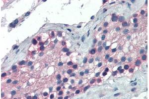 Human Testis (formalin-fixed, paraffin-embedded) stained with FOXE1 antibody ABIN337218 at 2. (FOXE1 Antikörper  (AA 361-373))