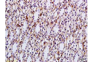 Formalin-fixed and paraffin embedded: rat kidney tissue labeled with Anti-AQP-2 Polyclonal Antibody, Unconjugated (ABIN1385618) at 1:200, followed by conjugation to the secondary antibody and DAB staining (AQP2 Antikörper  (AA 101-200))