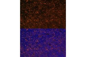 Immunofluorescence analysis of mouse thymus using CD27 antibody (ABIN3022680, ABIN3022681, ABIN3022682 and ABIN6219092) at dilution of 1:100. (CD27 Antikörper  (AA 20-191))