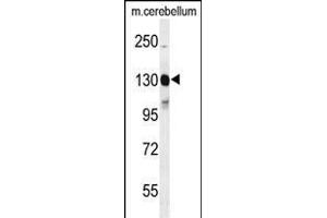 Western blot analysis of KIT Antibody  g in mouse cerebellum tissue lysates (35 μg/lane). (KIT Antikörper  (AA 680-711))