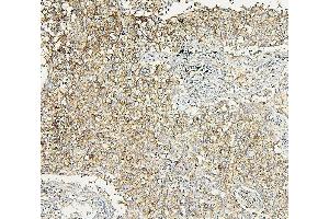 IHC analysis of ALDOA using anti-ALDOA antibody (ABIN7601907). (ALDOA Antikörper  (AA 50-364))