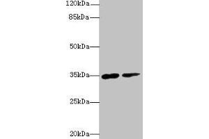 Western blot All lanes: RNF148 antibody at 6 μg/mL Lane 1: Hela whole cell lysate Lane 2: HepG2 whole cell lysate Secondary Goat polyclonal to rabbit IgG at 1/10000 dilution Predicted band size: 35 kDa Observed band size: 35 kDa (RNF148 Antikörper  (AA 208-305))
