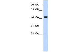 Western Blotting (WB) image for anti-Sphingomyelin Synthase 2 (SGMS2) antibody (ABIN2459622) (Sphingomyelin Synthase 2 Antikörper)