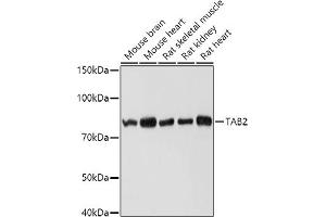 Western blot analysis of extracts of various cell lines, using T antibody (ABIN6131433, ABIN6148797, ABIN6148798 and ABIN6225202) at 1:1000 dilution. (TAB2 Antikörper  (AA 350-693))