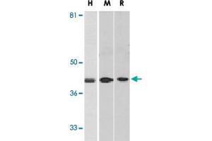 Western blot analysis of DAPK2 in A-431 (H), mouse spleen (M), and rat kidney (R) lysates with DAPK2 polyclonal antibody  at 1 ug/mL . (DAPK2 Antikörper  (C-Term))