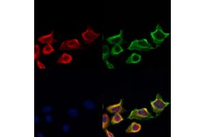 ABIN6258875 and ABIN6274225 staining Hela cells by IF/ICC.