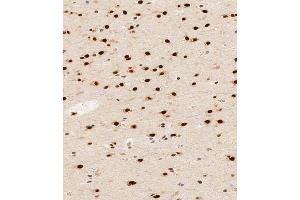 Immunohistochemistry (Paraffin-embedded Sections) (IHC (p)) image for anti-Heterogeneous Nuclear Ribonucleoprotein R (HNRNPR) (AA 95-123), (N-Term) antibody (ABIN1539662)