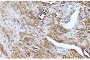 Immunohistochemistry of paraffin-embedded Mouse heart using N-WASP Polyclonal Antibody at dilution of 1:100 (40x lens).