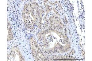 IHC analysis of RBM22 using anti-RBM22 antibody (ABIN7600268). (RBM22 Antikörper  (AA 17-406))