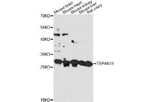 Western blot analysis of extracts of various cell lines, using TSPAN31 antibody. (TSPAN31 Antikörper)