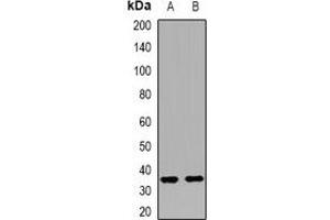 Western blot analysis of LPAAT alpha expression in mouse kidney (A), mouse brain (B) whole cell lysates. (AGPAT1 Antikörper)