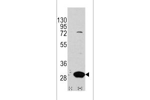 Western blot analysis of Latexin using rabbit polyclonal Latexin Antibody using 293 cell lysates (2 ug/lane) either nontransfected (Lane 1) or transiently transfected with the LXN gene (Lane 2). (Latexin Antikörper  (AA 78-107))