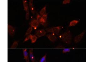 Immunofluorescence analysis of NIH/3T3 cells using IKBKE Polyclonal Antibody at dilution of 1:100. (IKKi/IKKe Antikörper)