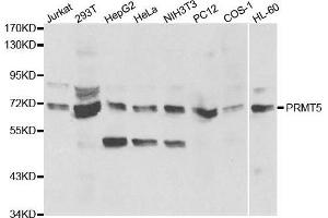 Western blot analysis of extracts of various cell lines, using PRMT5 antibody. (PRMT5 Antikörper  (AA 40-140))