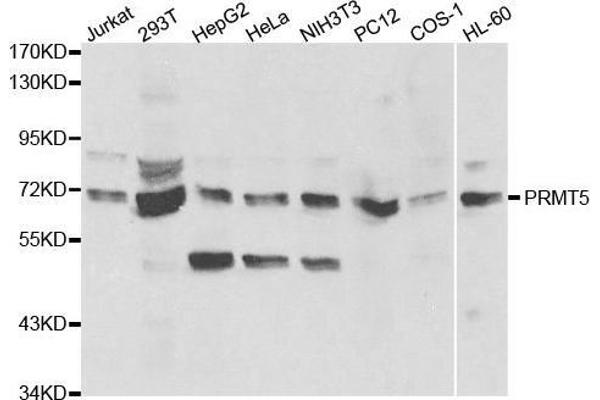 PRMT5 antibody  (AA 40-140)