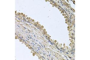 Immunohistochemistry of paraffin-embedded human prostate using MEMO1 antibody  at dilution of 1:100 (40x lens).