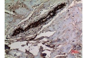 Immunohistochemistry (IHC) analysis of paraffin-embedded Human Breast, antibody was diluted at 1:100. (KRT8 Antikörper  (acLys483))