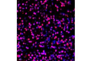 Immunofluorescence of paraffin embedded rat embryonic rat using BRN3A (ABIN7075163) at dilution of 1:650 (400x lens)