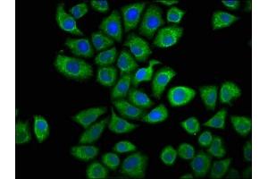 Immunofluorescence staining of Hela cells with ABIN7146664 at 1:66, counter-stained with DAPI. (Caprin-1 Antikörper  (AA 573-703))