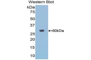 Western Blotting (WB) image for anti-Acidic (Leucine-Rich) Nuclear phosphoprotein 32 Family, Member A (ANP32A) (AA 2-175) antibody (ABIN1077732) (PHAP1 Antikörper  (AA 2-175))