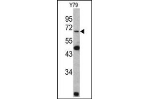Western blot: Lamin B2 Antibody staining of Y79 cell line lysates (35 µg/lane). (Lamin B2 Antikörper  (C-Term))